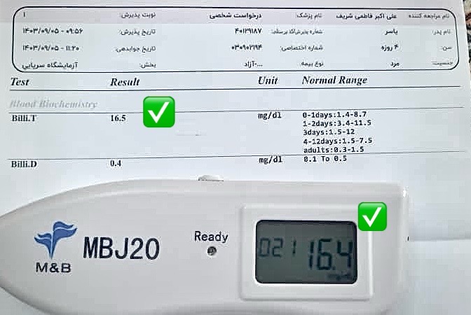 نمونه تست زردی نوزاد در تهراناندازه گیری زردی نوزاد