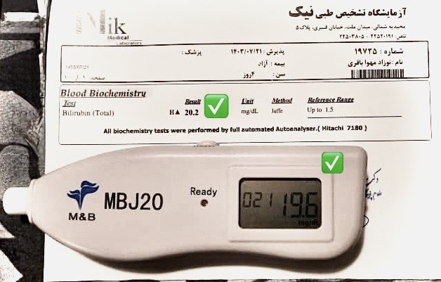 دقت دستگاه تست زردی زردی نوزاد